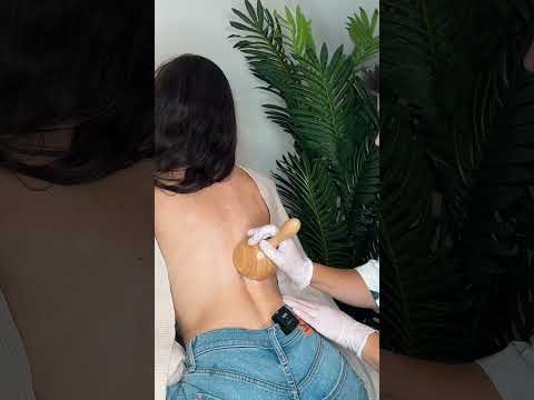 ASMR Back Cupping for Lymph Drainage Medical Roleplay #asmrrealperson