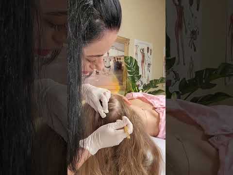 ASMR Scalp Check & Sensory Tests on the Scalp for Relaxation (Real Person #asmr )