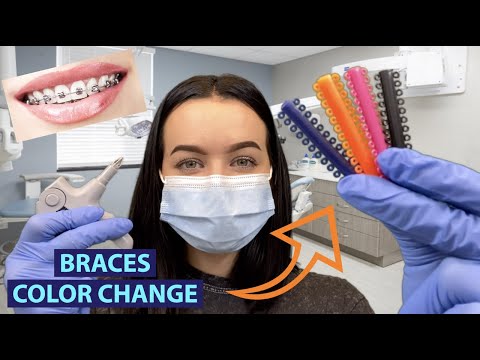 [ASMR] Changing Your Braces Wire & Bands RP