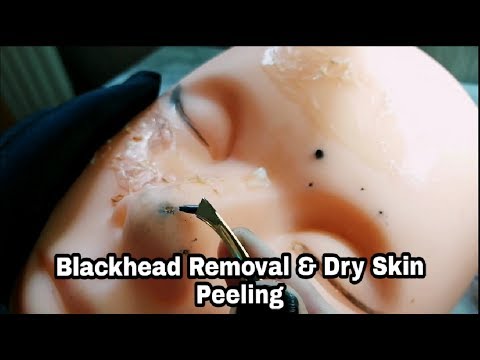 ASMR BlackHead Removal/Dry Skin Peeling| Satisfying