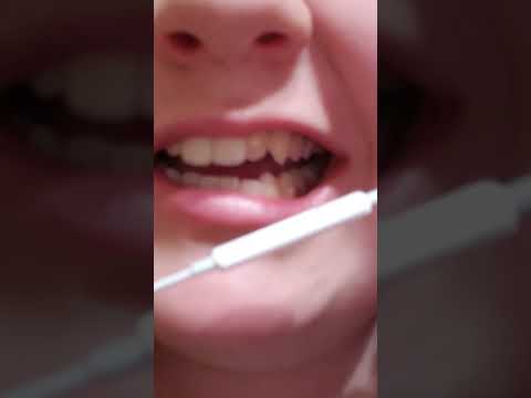 asmr biting/teeth sounds