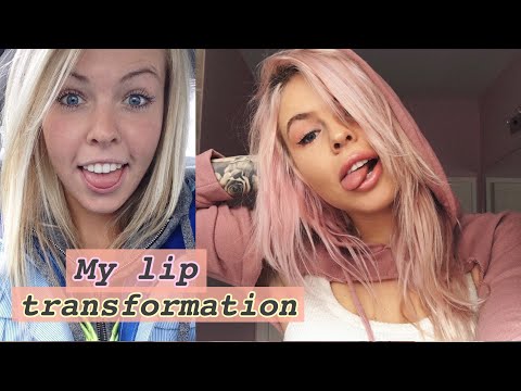 My Lip Transformation | ASMR close whispering