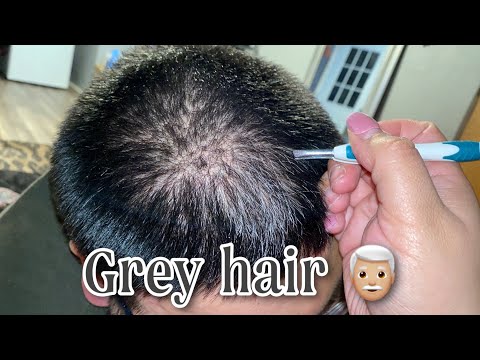 ASMR| Plucking grey hair on real person 👨🏼‍🦳- no talking, hair sounds 💤