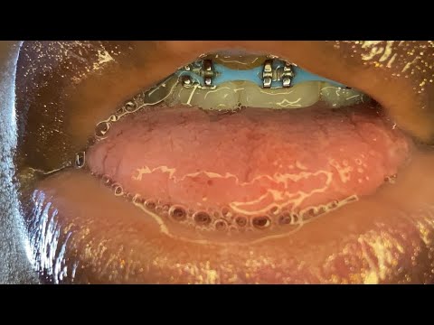 ASMR Lens Licking | Uvula Exam | Wet Mouth Sounds💦