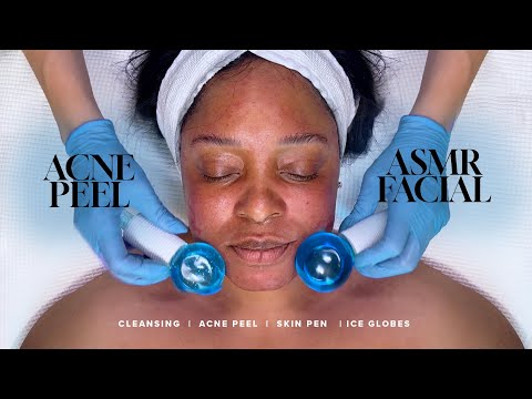 ASMR FACIAL | Incredible Facial Transformation | Banish Acne Forever!