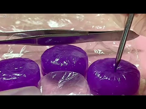 asmr - Slime acne squeezing + extraction