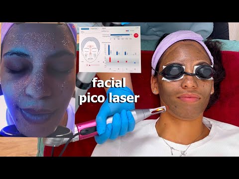 ASMR: I Tried a PICO LASER Facial Treatment for Glowing Skin!