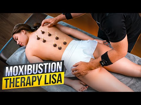 BACK CRACKING AND DEEP TISSUE BACK MASSAGE - MOXIBUSTION AND CHIROPRACTIC FOR LISA