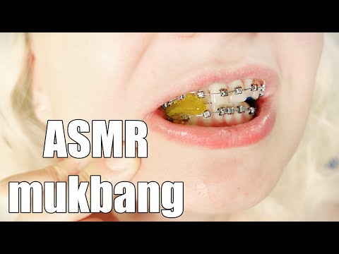 Braces: eating jelly sweets close up!