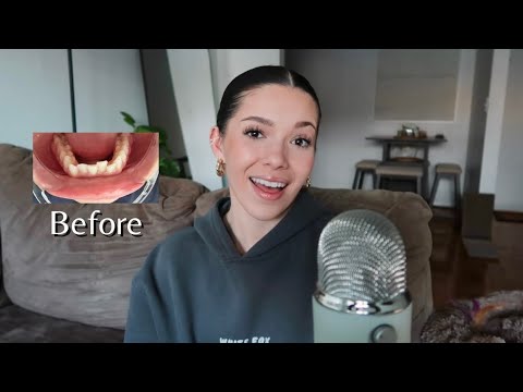 ASMR - My Teeth Straightening Journey | Was It Worth It???