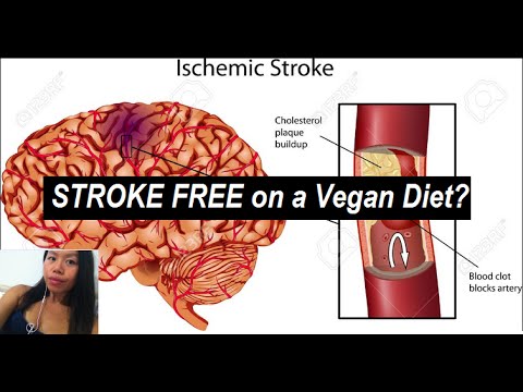 100% Stroke Free on a Vegan Diet?