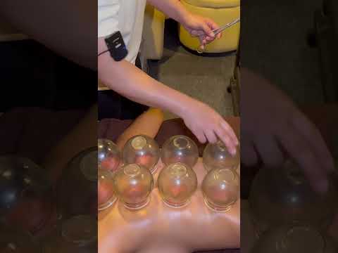 ASMR: STRONG CHINESE Back Shoulder Neck Massage with Cupping! #shorts