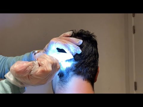 ASMR⚡️Checking the scalp for lice with gloves (real person)