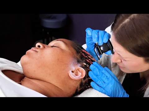 Detailed Face Mapping Skin Check & Scalp Exam for Healthy Skin | Real Person ASMR