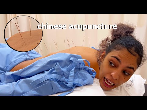ASMR: I Tried CHINESE ACUPUNCTURE with TUINA MASSAGE to Fix my Back!