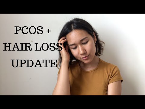My PCOS, Amenorrhea & Female Pattern Hair Loss (Androgenetic Alopecia) Treatment Update
