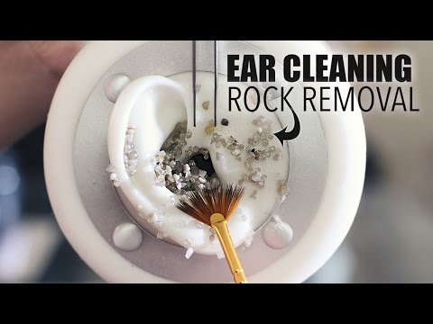 ASMR 3Dio Sticky Rough EAR CLEANING ROCK Removal