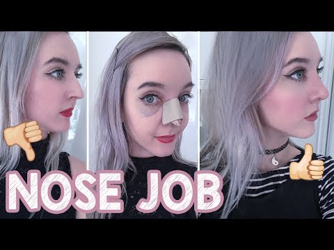 I GOT A NOSE JOB?! ♥ Experience, Recovery, Before & After