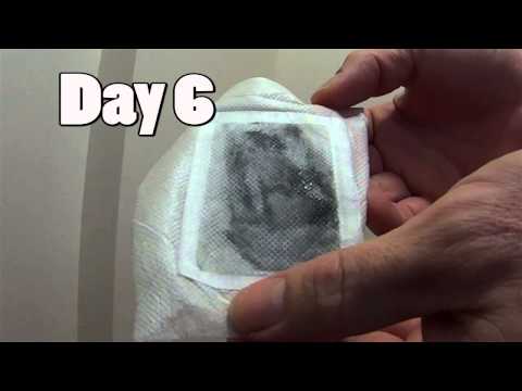 Foot Pad Detox - Day 3 to 6 Easy way to Rid Body of Toxins