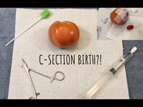 [ASMR] Surgery On Tomato - Gives Birth?!?!