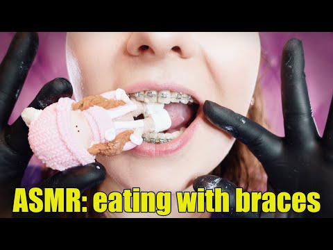 ASMR: eating with braces