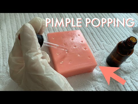 ASMR PIMPLE POPPING SQUEEZING - Popping Squeeze