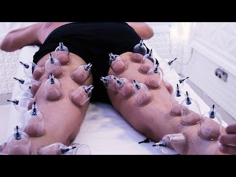 CUPPING THERAPY by PINKBARBER 😱 the most PAINFUL MASSAGE of my LIFE