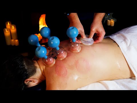 ASMR Back Massage with Cupping | SLEEP THERAPY [No Talking]