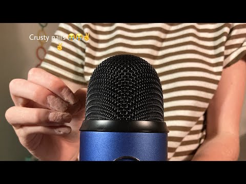 ASMR// nail on nail tapping and mic scratching and tapping✌️😭