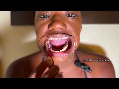 ASMR brushing teeth, tongue ring, tongue & mouth sounds with @melanintongue407