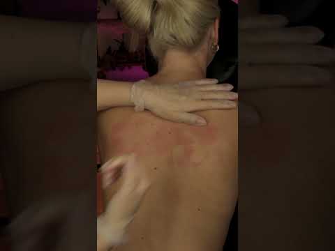 ASMR Back Skin Cracking & Pulling