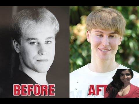 Justin Bieber 2013: Song writer Toby Sheldon Had surgery to look like Justin Bieber ! - my thoughts