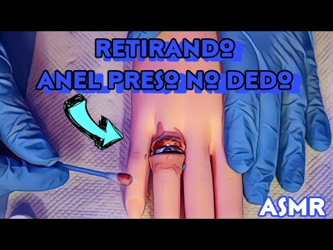 ASMR CIRÚRGICO: tirando anel emperrado do dedo (asmr medico)