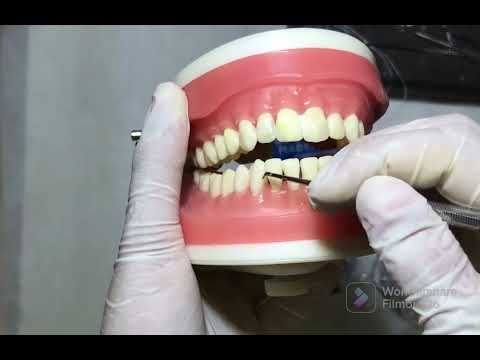 Asmr Dentista clareando seus dentes Asmr caseiro