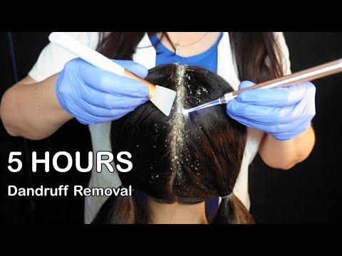 ASMR ~ 5 HOURS ~ Scalp Check with Bad Results & Dandruff Treatment (Whispered)