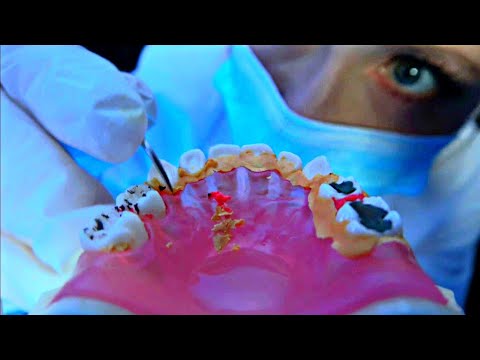 ASMR Dentist Cleans Your Teeth