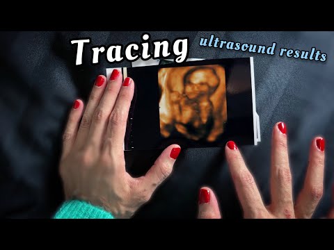 ASMR tracing no talking, tracing photos (Ultra Sounds Photos) #pregnancy