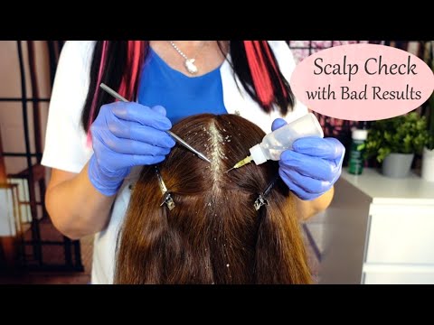 ASMR Satisfying Scalp Check & Dandruff Treatment (Whispered)