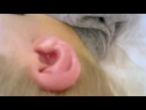 ASMR Ear Cleaning ( Lots Of Wax)