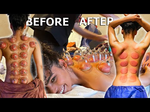 ASMR: relaxing CHINESE CUPPING THERAPY and MASSAGE!