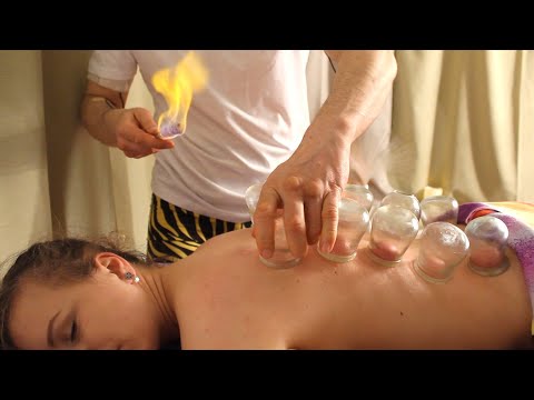 Fire Cupping Therapy ASMR | Cup Back Massage and Pain Relief