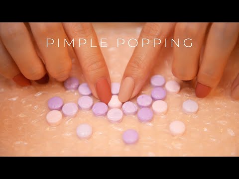 ASMR Relaxing & Crinkly Pimple Popping(No Talking)