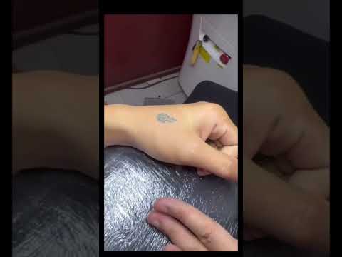 Tattoo laser removal 😲😵‍💫oddly Satisfying