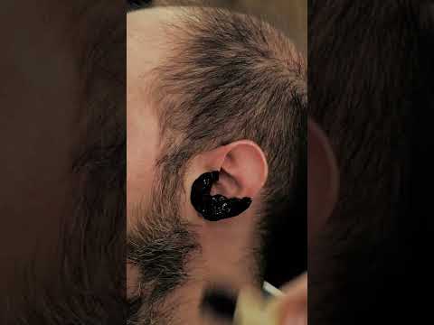 #asmr | EAR #waxing | Turkish Barber