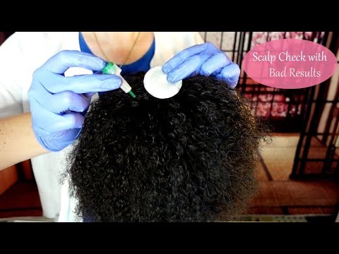 ASMR Medical Scalp Check & Treatment on Afro Hair (Whispered)