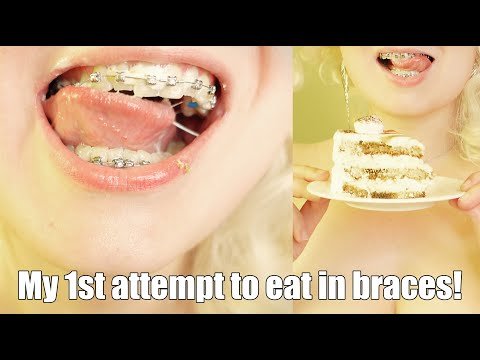 My first attempt to eat something in braces! Mukbang