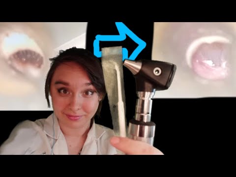 I did a real medical ear cleaning for you (ASMR)