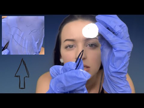 [ASMR] Removing Your LONG Ingrown Facial Hairs RP