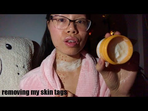 ASMR get UNREADY with me + REMOVING MY SKIN TAGS w. Natural Remedies! (Night Time Skin Care)