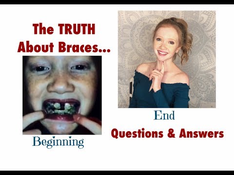 HUGE Q&A - The TRUTH About BRACES..... With PICTURES!